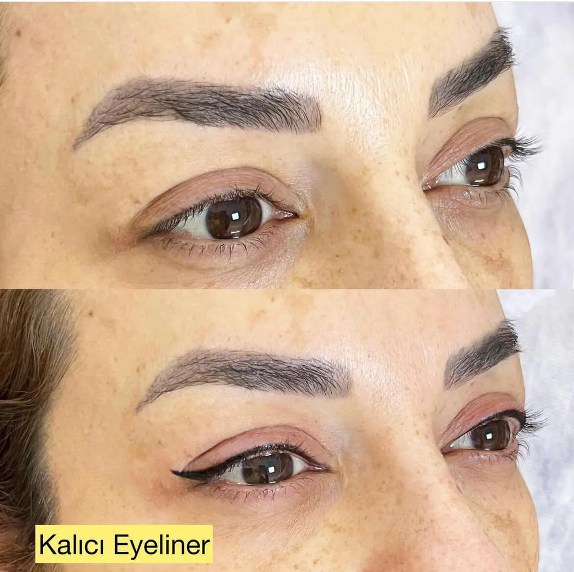 Şişli Arist uygulama görseli