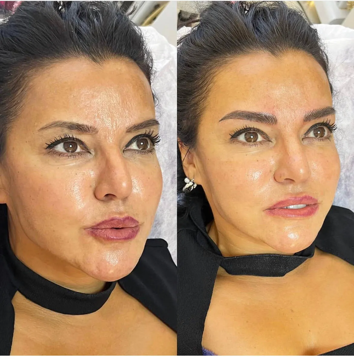 Şişli Arist uygulama görseli